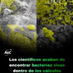 Científicos encontraron bacterias vivas… literalmente dentro de los cálculos renales. Científicos encontraron bacterias vivas… literalmente dentro de los cálculos renales.